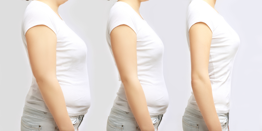 image comparison after